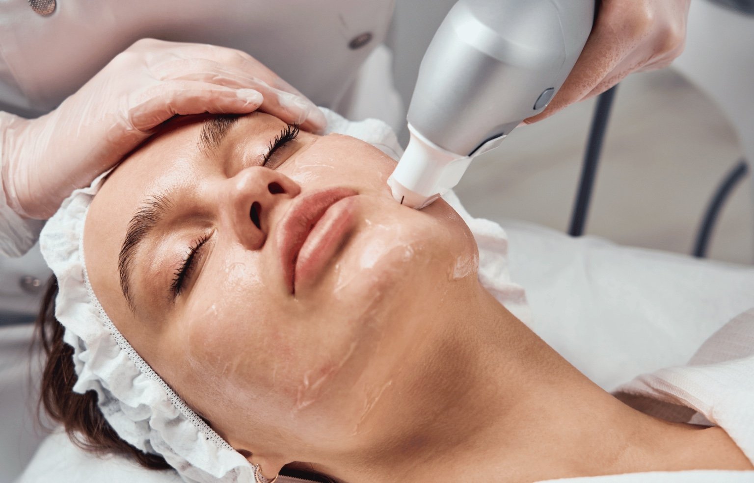 Ultraformer III facial
